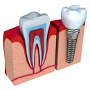 East Coast Dental Design: Mary Ann Garcia DDS - Dentists
