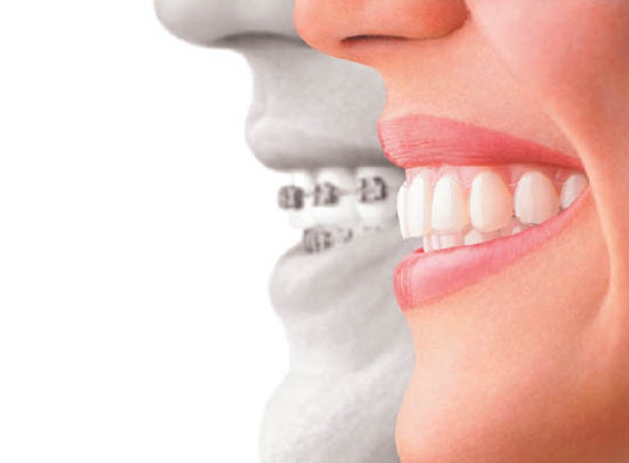 Kaprelian Orthodontics - Sunnyvale, CA