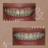 Dr. James Slaman DDS, PC gallery