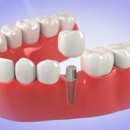 Oaktown Dental - Implant Dentistry