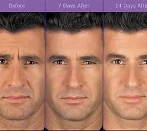 Ageless Expressions MedSpa - Littleton / Golden - Littleton, CO