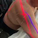 Cramer Chiropractic - Chiropractors & Chiropractic Services