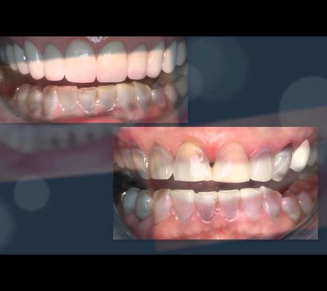 Dr. Craig Carlson DDS - San Antonio, TX