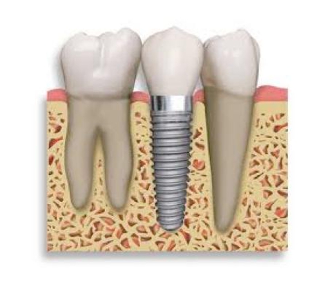 Whyalla Dental Care (SA) Pty Ltd - Whyalla Playford, SA