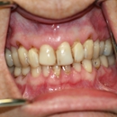 Donald K. Johnson DMD Cosmetic and Family Dentistry - Implant Dentistry