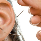 Michael L Miller L.ac Acupuncture