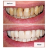 Almaden Valley Smile Design gallery