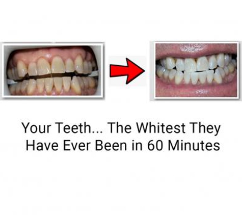 Rock Star Teeth Whitening - Peoria, AZ