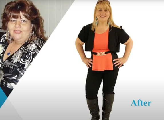 Weight Loss Surgery at Mount Sinai Queens - Astoria, NY