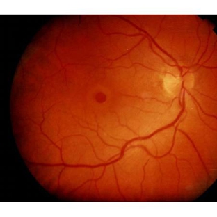Sydney Retina - Sydney, NSW