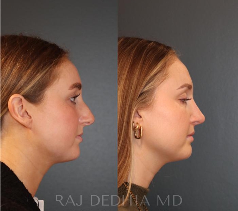 Raj Dedhia, MD Facial Plastic Surgery - San Francisco, CA