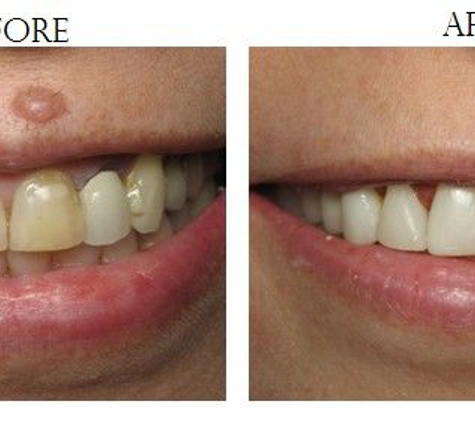 StarBrite Dental-Dr. Munira Lokhandwala DDS, FAGD, FICOI - Fremont, CA