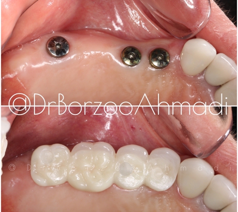 Dr. Borzoo Ahmadi DDS - West Hollywood, CA