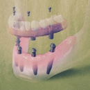 Lindenhurst Family Dental - Dental Clinics