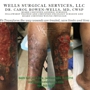 Wells Surgical Services LLC