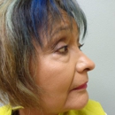 Dr Anh Lee Plastic Surgery - Physicians & Surgeons, Plastic & Reconstructive