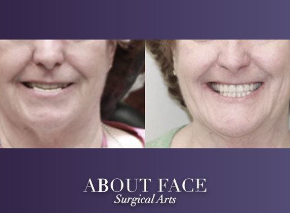 About Face Surgical Arts: Khurram A. Khan BDS, DMD - Cincinnati, OH