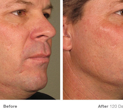 Visage Dermatology - St Petersburg, FL