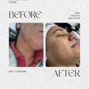 Bare Complexion Studio - Clinics