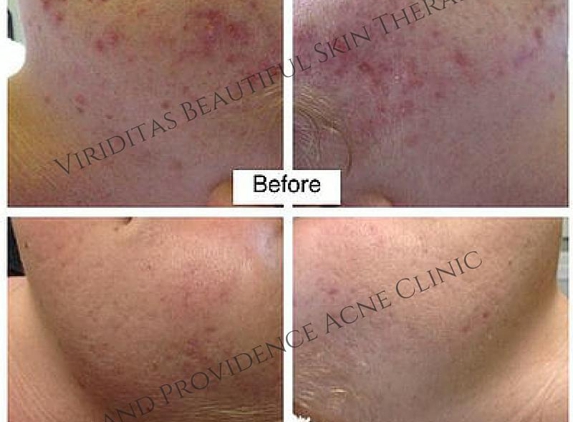 Viriditas Beautiful Skin Therapy & Providence Skin Care - Providence, RI