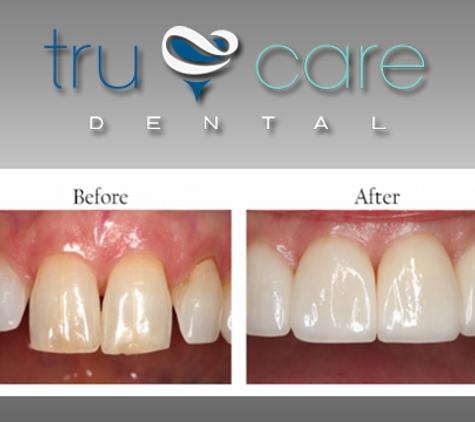 Tru Care Dental - Albuquerque, NM