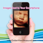 Goldenview Ultrasound