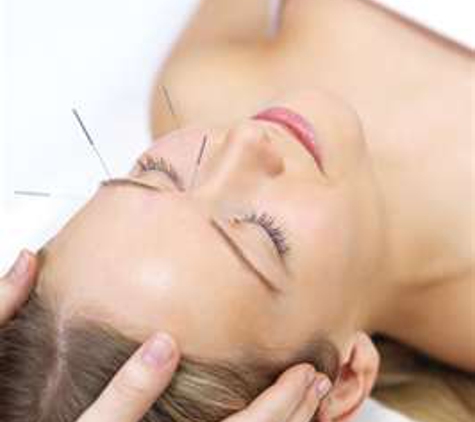 Giordano Acupuncture - New York, NY