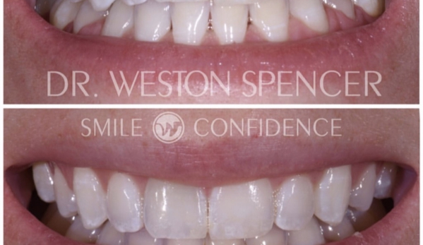 Weston Spencer DDS, Cosmetic Comprehensive Dentistry - La Jolla, CA