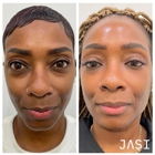 JASI Skin + Wellness Med Spa