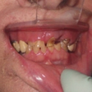 David W Hyten DMD, General Dentistry - Cosmetic Dentistry