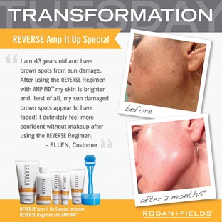 Rodan and Fields Consultant-Betsy Elwood