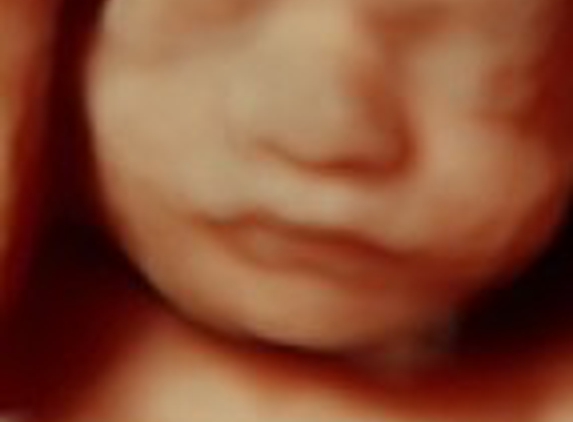 Bundle of Love 3D/4D 5D HDLive Ultrasound & Baby Boutique - Gastonia, NC. 5D-HD 24 weeks