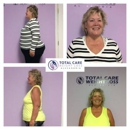 Total Care Weight Loss - Weight Control Services
