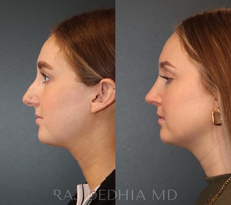 Raj Dedhia, MD Facial Plastic Surgery - San Francisco, CA