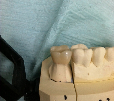 Precision Dental Ceramics Laboratory - Houston, TX