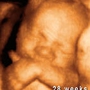 Fetal Fotos Utah County