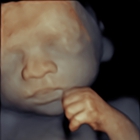 Prenatal Universe Ultrasound