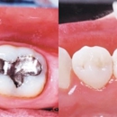 Northpointe Smiles - Implant Dentistry
