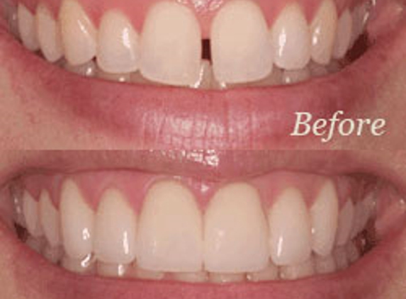 Hermosa Dental & Orthodontics - Dallas, TX