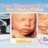 Baby Love Ultrasound gallery