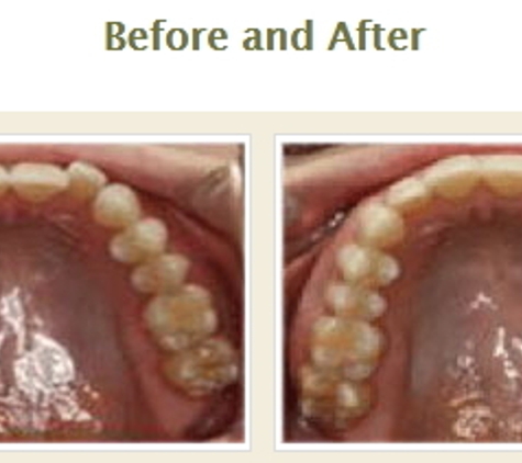 StarBrite Dental - Dublin - Dublin, CA