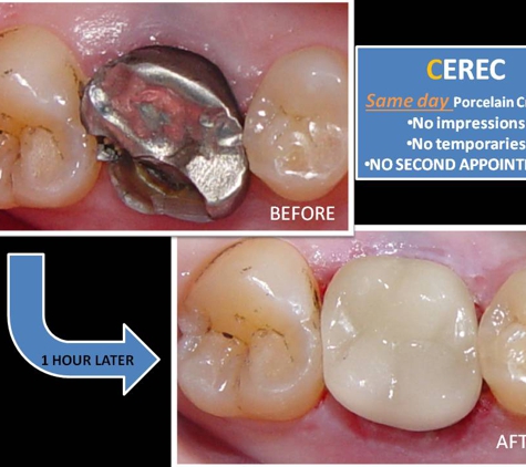 Sundial Dental Taree - Taree, NSW. Saving teeth using cerec
