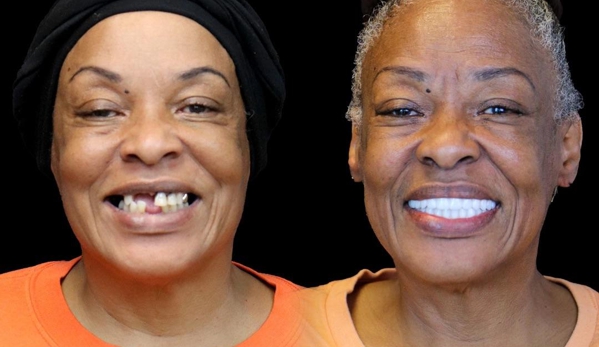 Smile Now Denver Dentures and Implants - Westminster, CO