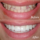 Smiles by Beck & Bailey - Cosmetic Dentistry