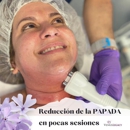Elite Laser Esthetics - Hair Removal