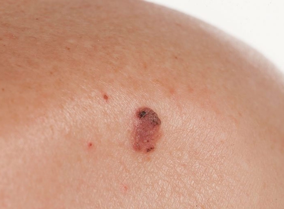 Port Macquarie Skin Cancer Clinic - Port Macquarie, NSW