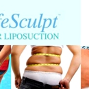 SafeSculpt Laser Liposuction - Physicians & Surgeons, Weight Loss Management