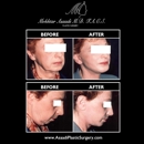 Asaadi Plastic Surgery - Physicians & Surgeons, Cosmetic Surgery