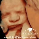 Goldenview Ultrasound - Medical Imaging Services