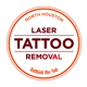 North Houston Laser Tattoo Removal